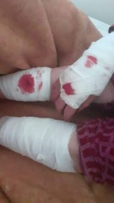سيدي افني :ضحايا “الحلوف” في ارتفاع وسط صمت الجهات المسؤولة