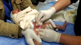 وفاة رضيع بسبب ختانه بكلميم