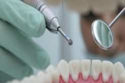 فدرالية صانعي الأسنان تنفي خبر وفاة امرأة بطانطان