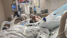 التنفس الصناعي.. هل ينقذ المصابين بفيروس كورونا؟