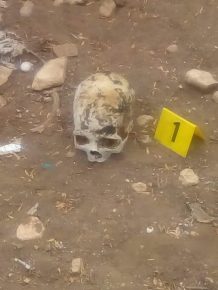 العثور على جمجمة طفل في منطقة الغزوة بأكادير