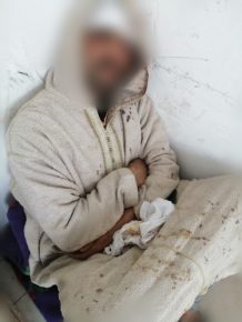 اعتداء مجموعة من الرحل على أحد المواطنين بميرلفت
